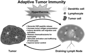 Hyperthermia and Cancer